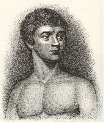A portrait of Victor of Aveyron.