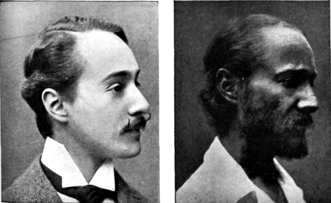 Two profiles of the same man, one well groomed and healthy the other worn