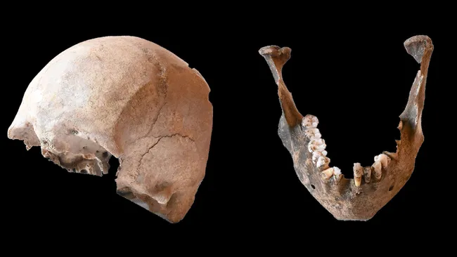A skull and jawbone